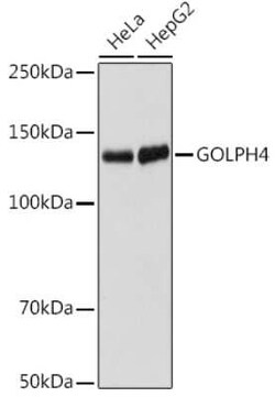 GOLPH4 Rabbit anti-Human, Clone: 10J7E6, Novus Biologicals 100 &mu;g | Buy Online | Novus Biologicals | Fisher Scientific