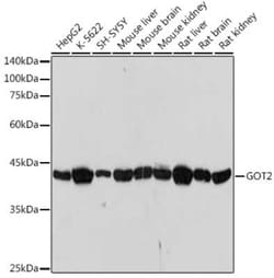 GOT2 Rabbit anti-Human, Mouse, Rat, Clone: 4J7O3, Novus Biologicals 100 &mu;g | Buy Online | Novus Biologicals | Fisher Scientific