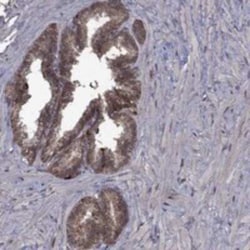 GPAA1 Rabbit anti-Human, Polyclonal, Novus Biologicals 25 &mu;g; Unconjugated:Antibodies,