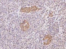 GPD2 Antibody, Novus Biologicals&trade;