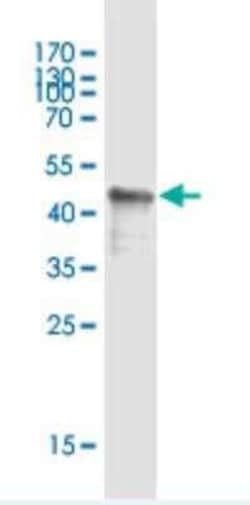 GPIHBP1 Antibody (1F9), Novus Biologicals 0.1 mg; Unconjugated:Antibodies,