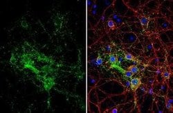 GPM6A Antibody, Novus Biologicals 100 &mu;g | Buy Online | Novus Biologicals | Fisher Scientific