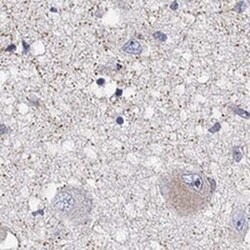 GPR103 Rabbit anti-Human, Polyclonal, Novus Biologicals:Antibodies:Primary