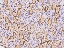 GPR113 Antibody, Novus Biologicals:Antibodies:Primary Antibodies