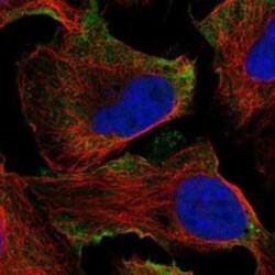 GPR133 Rabbit anti-Human, Polyclonal, Novus Biologicals 25 &mu;g; Unconjugated:Antibodies,