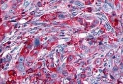GPR133 Antibody, Novus Biologicals 50 &mu;g; Unconjugated:Antibodies, Polyclonal
