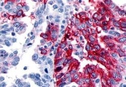 GPR133 Antibody, Novus Biologicals 50 &mu;g; Unconjugated:Antibodies, Polyclonal
