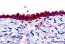 GPR133 Antibody, Novus Biologicals 50 &mu;g; Unconjugated:Antibodies, Polyclonal