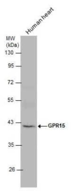 GPR15 Antibody, Novus Biologicals 100 &mu;g | Buy Online | Novus Biologicals | Fisher Scientific