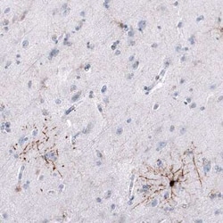 GPR17 Antibody (CL10474), Novus Biologicals:Antibodies:Primary Antibodies