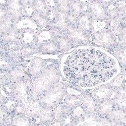 GPR17 Antibody (CL10474), Novus Biologicals:Antibodies:Primary Antibodies