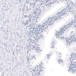 GPR17 Antibody (CL10474), Novus Biologicals:Antibodies:Primary Antibodies
