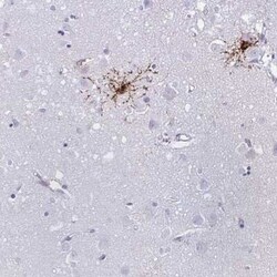 GPR17 Antibody, Novus Biologicals 0.1 mL; Unconjugated:Antibodies, Polyclonal