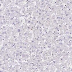 GPR17 Antibody, Novus Biologicals 0.1 mL; Unconjugated:Antibodies, Polyclonal