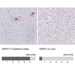 GPR17 Antibody, Novus Biologicals 0.1 mL; Unconjugated:Antibodies, Polyclonal