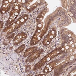 GPR172A Antibody, Novus Biologicals 25 &mu;L, Unconjugated:Antibodies,