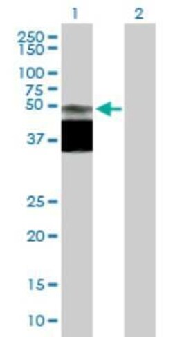 GPR172B Antibody, Novus Biologicals 0.05 mg | Buy Online | Novus Biologicals | Fisher Scientific