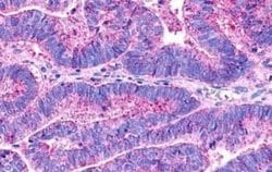 GPR18 Antibody, Novus Biologicals 50 &mu;g; Unconjugated:Antibodies, Polyclonal