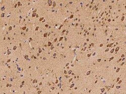 GPR19 Antibody, Novus Biologicals 100 &mu;g | Buy Online | Novus Biologicals | Fisher Scientific