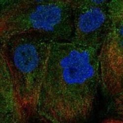 GPR20 Rabbit anti-Human, Polyclonal, Novus Biologicals 25 &mu;g; Unconjugated:Antibodies,