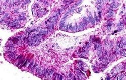 GPR21 Antibody, Novus Biologicals 50 &mu;g | Buy Online | Novus Biologicals | Fisher Scientific