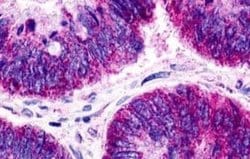 GPR21 Antibody, Novus Biologicals 50 &mu;g; Unconjugated:Antibodies, Polyclonal