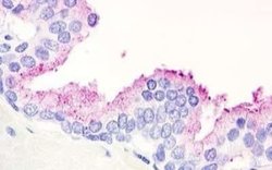 GPR21 Antibody, Novus Biologicals 50 &mu;g | Buy Online | Novus Biologicals | Fisher Scientific