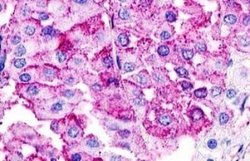 GPR21 Antibody, Novus Biologicals 50 &mu;g | Buy Online | Novus Biologicals | Fisher Scientific