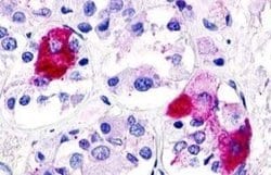 GPR21 Antibody, Novus Biologicals 50 &mu;g; Unconjugated:Antibodies, Polyclonal