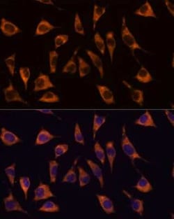 GPR22 Rabbit anti-Human, Mouse, Rat, Polyclonal, Novus Biologicals:Antibodies:Primary