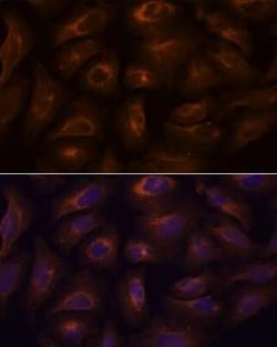 GPR22 Rabbit anti-Human, Mouse, Rat, Polyclonal, Novus Biologicals:Antibodies:Primary