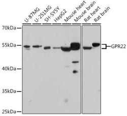 GPR22 Rabbit anti-Human, Mouse, Rat, Polyclonal, Novus Biologicals:Antibodies:Primary