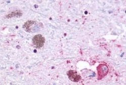 GPR27 Antibody, Novus Biologicals 50 &mu;g | Buy Online | Novus Biologicals | Fisher Scientific