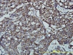 GPR3 Antibody (3B4-G3), Novus Biologicals 0.1 mg | Buy Online | Novus Biologicals | Fisher Scientific