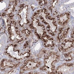 GPR82 Antibody, Novus Biologicals 25 &mu;L; Unconjugated:Antibodies, Polyclonal