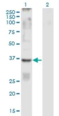 GPR84 Antibody (5C3), Novus Biologicals 0.1 mg; Unconjugated:Antibodies,