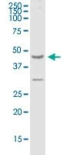 GPRC5A/RAI3 Antibody, Novus Biologicals 50 &mu;g | Buy Online | Novus Biologicals | Fisher Scientific