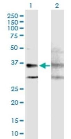 GPRC5A/RAI3 Antibody, Novus Biologicals 50 &mu;g | Buy Online | Novus Biologicals | Fisher Scientific