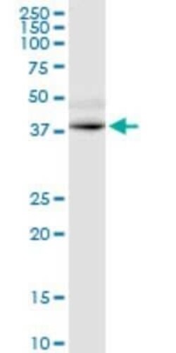 GPRC5D Antibody (6D9), Novus Biologicals 0.1 mg | Buy Online | Novus Biologicals | Fisher Scientific