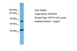 GPRC6A Rabbit anti-Human, Polyclonal, Novus Biologicals 0.1 mL | Buy Online | Novus Biologicals | Fisher Scientific