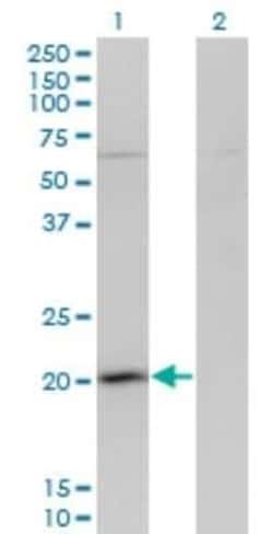 GPSM3 Antibody (1F11), Novus Biologicals 0.1 mg; Unconjugated:Antibodies,