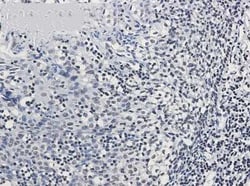 GR/NR3C1 Rabbit anti-Human, Clone: S02-1H0, Novus Biologicals 100 &mu;g;