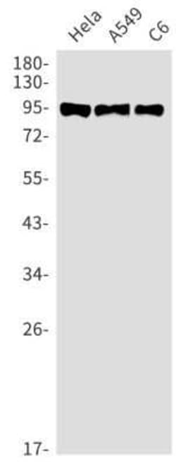 GR/NR3C1 Rabbit anti-Human, Clone: S02-1H0, Novus Biologicals 100 &mu;g;