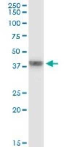 GRAP2 Antibody (1G12), Novus Biologicals 0.1 mg | Buy Online | Novus Biologicals | Fisher Scientific