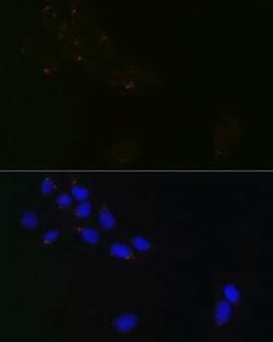 GRASP65 Rabbit anti-Human, Mouse, Rat, Clone: 3F2I1, Novus Biologicals 100 &mu;g | Buy Online | Novus Biologicals | Fisher Scientific