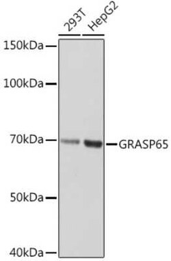 GRASP65 Rabbit anti-Human, Mouse, Rat, Clone: 3F2I1, Novus Biologicals 100 &mu;g | Buy Online | Novus Biologicals | Fisher Scientific