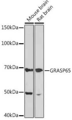 GRASP65 Rabbit anti-Human, Mouse, Rat, Clone: 3F2I1, Novus Biologicals 100 &mu;g | Buy Online | Novus Biologicals | Fisher Scientific