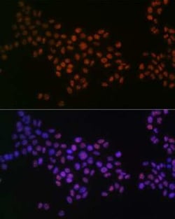 GRB2 Rabbit anti-Human, Mouse, Rat, Clone: 9K6H0, Novus Biologicals 100 &mu;g | Buy Online | Novus Biologicals | Fisher Scientific