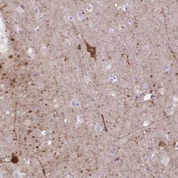 GRB7 Antibody, Novus Biologicals 25 &mu;L, Unconjugated:Antibodies, Polyclonal