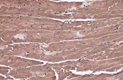 GRF2 Antibody, Novus Biologicals 100 &mu;g; Unconjugated:Antibodies, Polyclonal